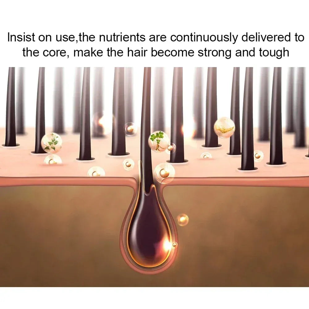 Natural Ginger Hair Growth Spray Hair Roots Fast Grow Anti Hair Loss Serum Liquid Scalp Damaged Treatment Repair Beauty Health