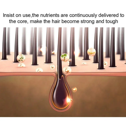 Natural Ginger Hair Growth Spray Hair Roots Fast Grow Anti Hair Loss Serum Liquid Scalp Damaged Treatment Repair Beauty Health