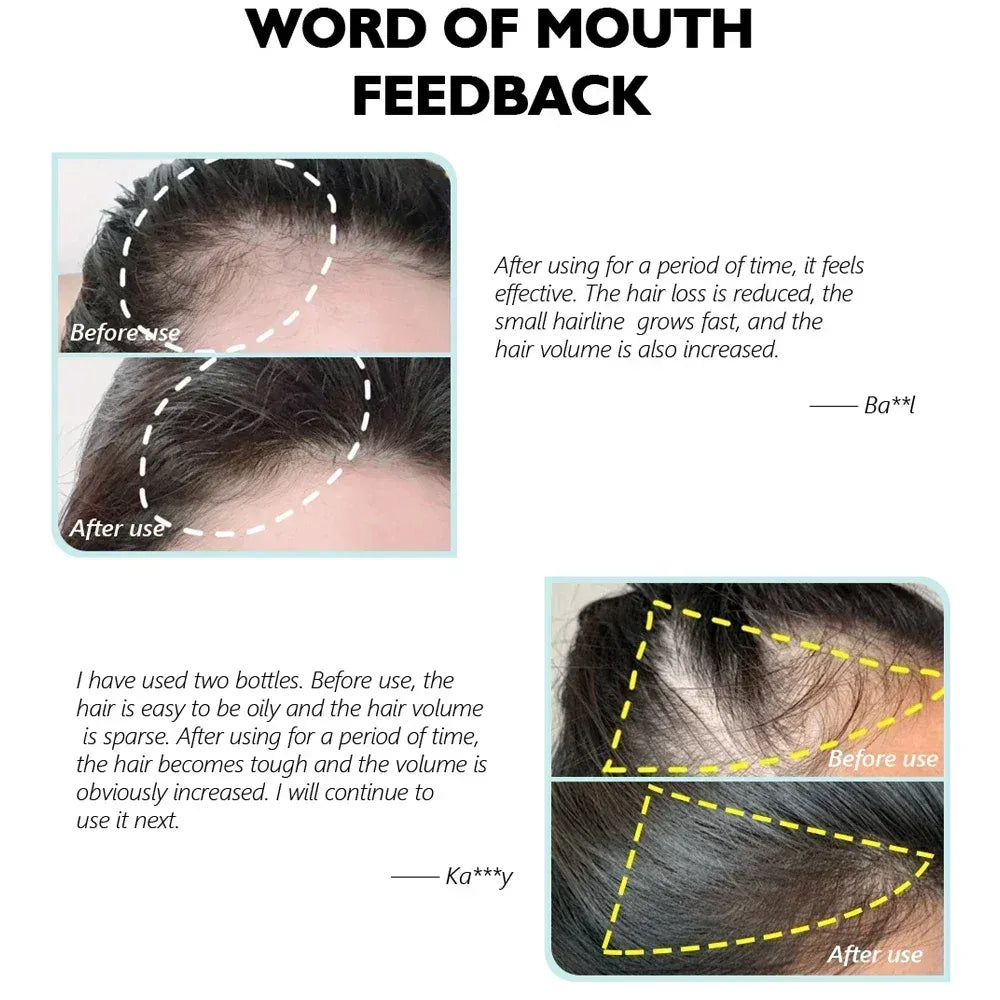 Natural Ginger Hair Growth Spray Hair Roots Fast Grow Anti Hair Loss Serum Liquid Scalp Damaged Treatment Repair Beauty Health