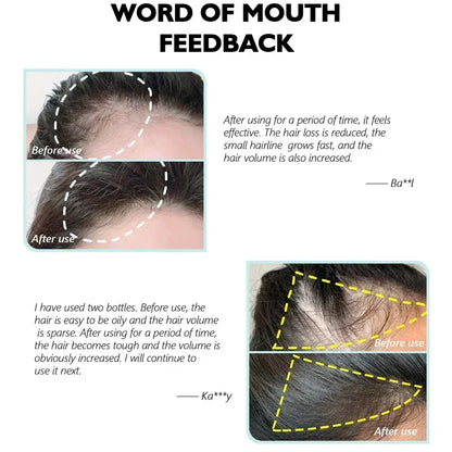 Natural Ginger Hair Growth Spray Hair Roots Fast Grow Anti Hair Loss Serum Liquid Scalp Damaged Treatment Repair Beauty Health